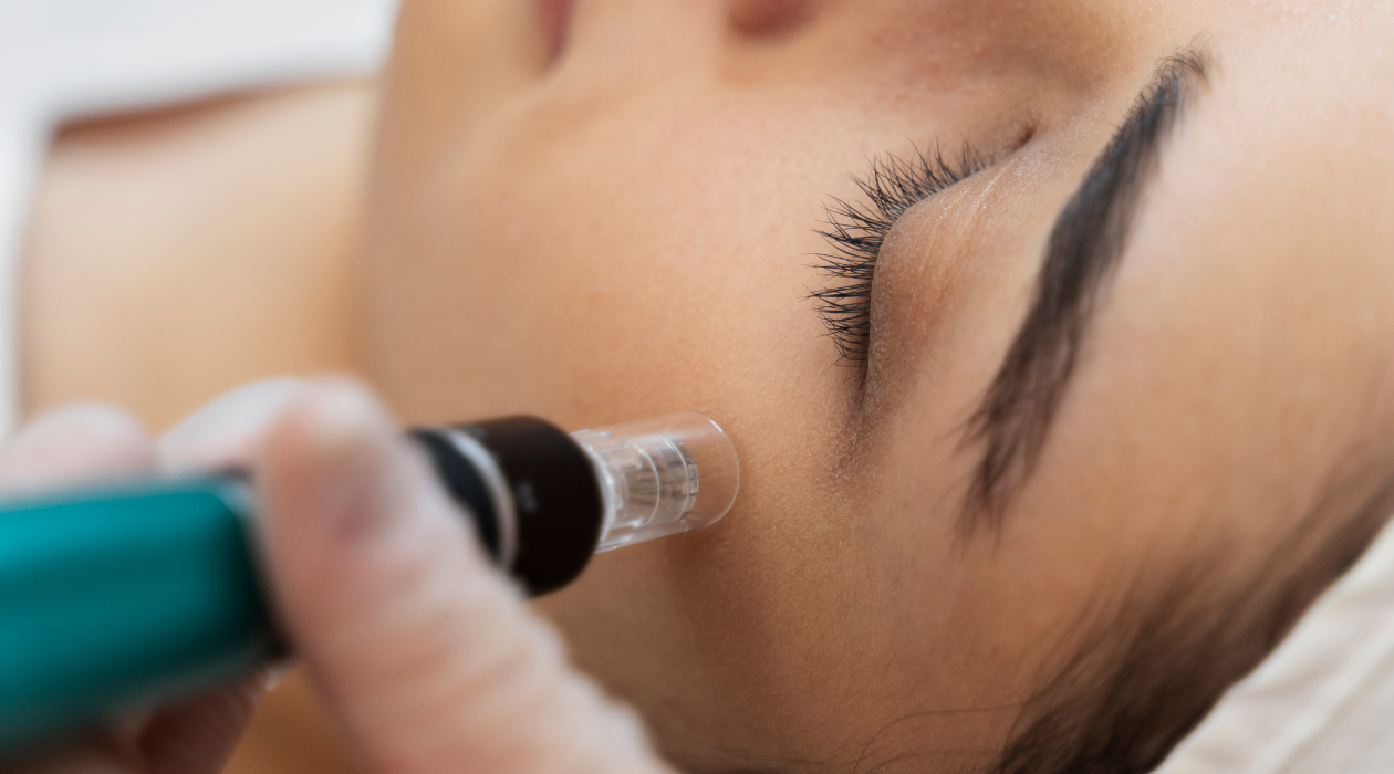 Level 4 Microneedling Course
